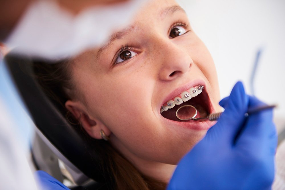 kids braces treatment in seawoods